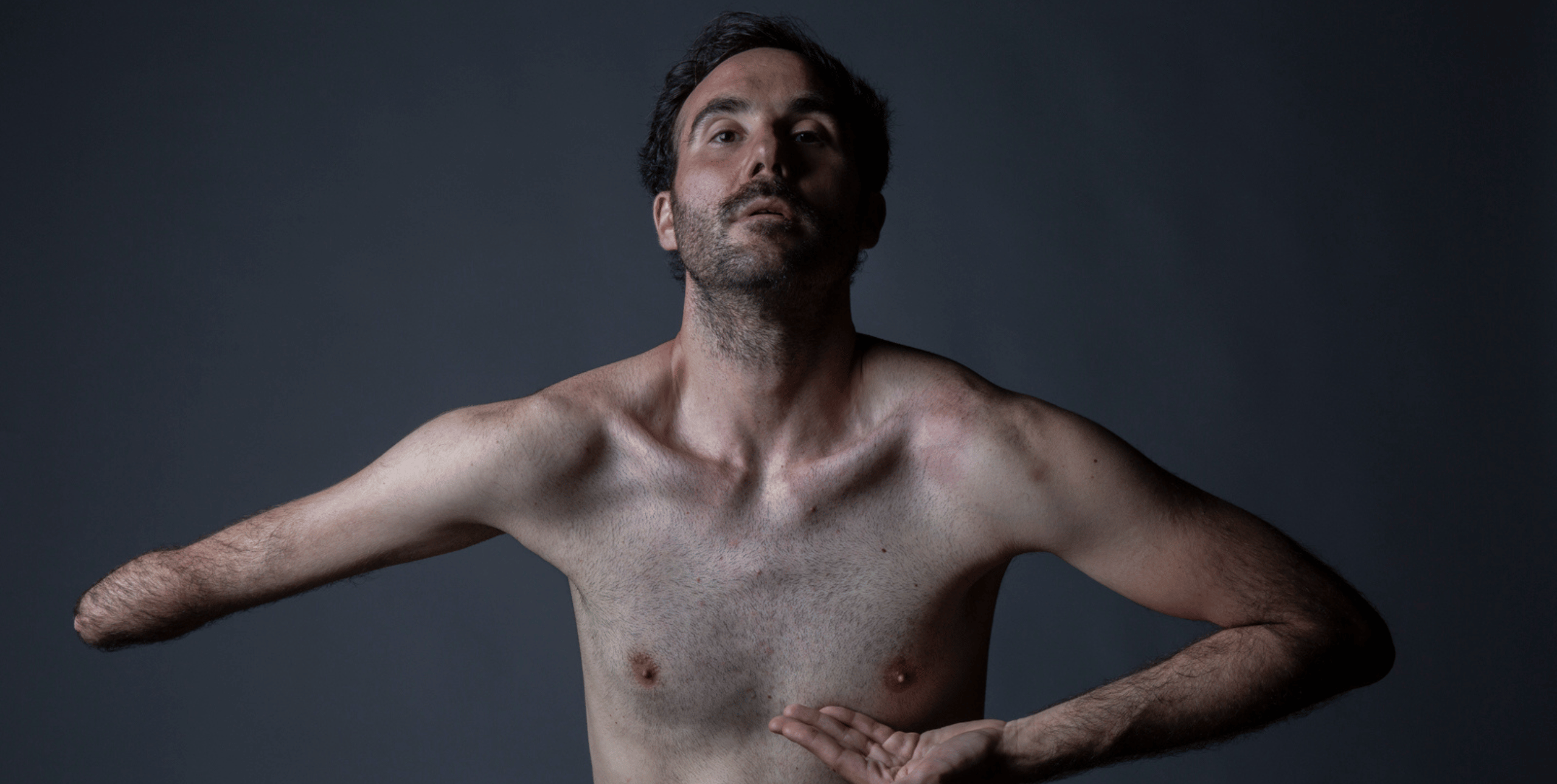  A shirtless man with a partially amputated left arm poses against a dark background. His right hand is placed under his chest, and he gazes upward with a thoughtful expression