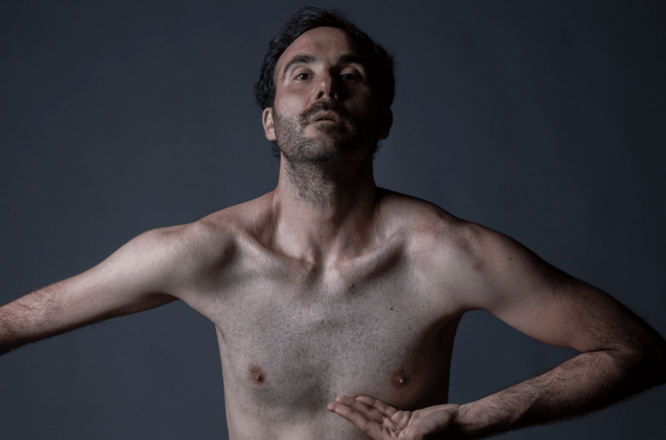  A shirtless man with a partially amputated left arm poses against a dark background. His right hand is placed under his chest, and he gazes upward with a thoughtful expression
